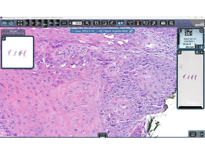 E1000 Dx Digital Pathology Solution