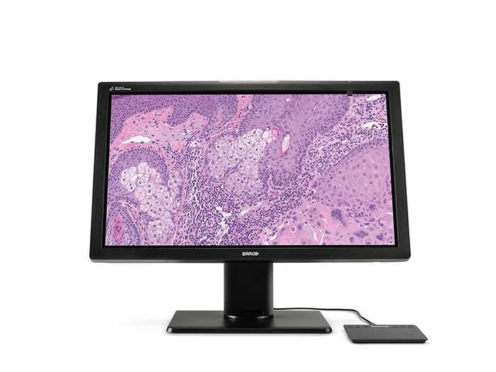 Barco Medical Display