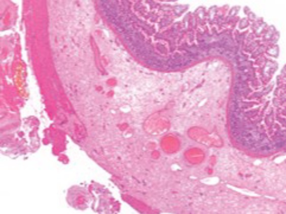 Epredia Revos image