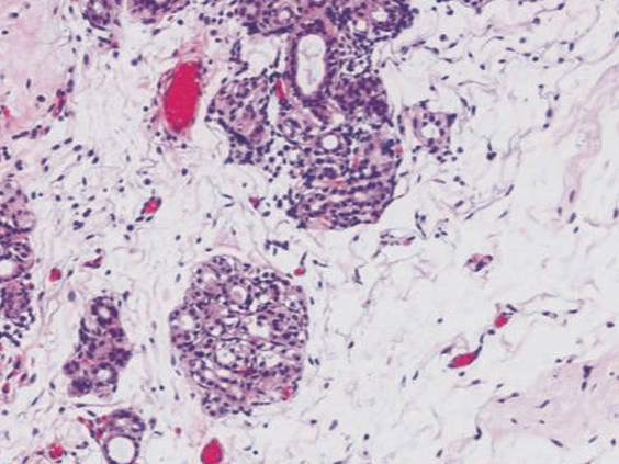 Epredia FFPE Image